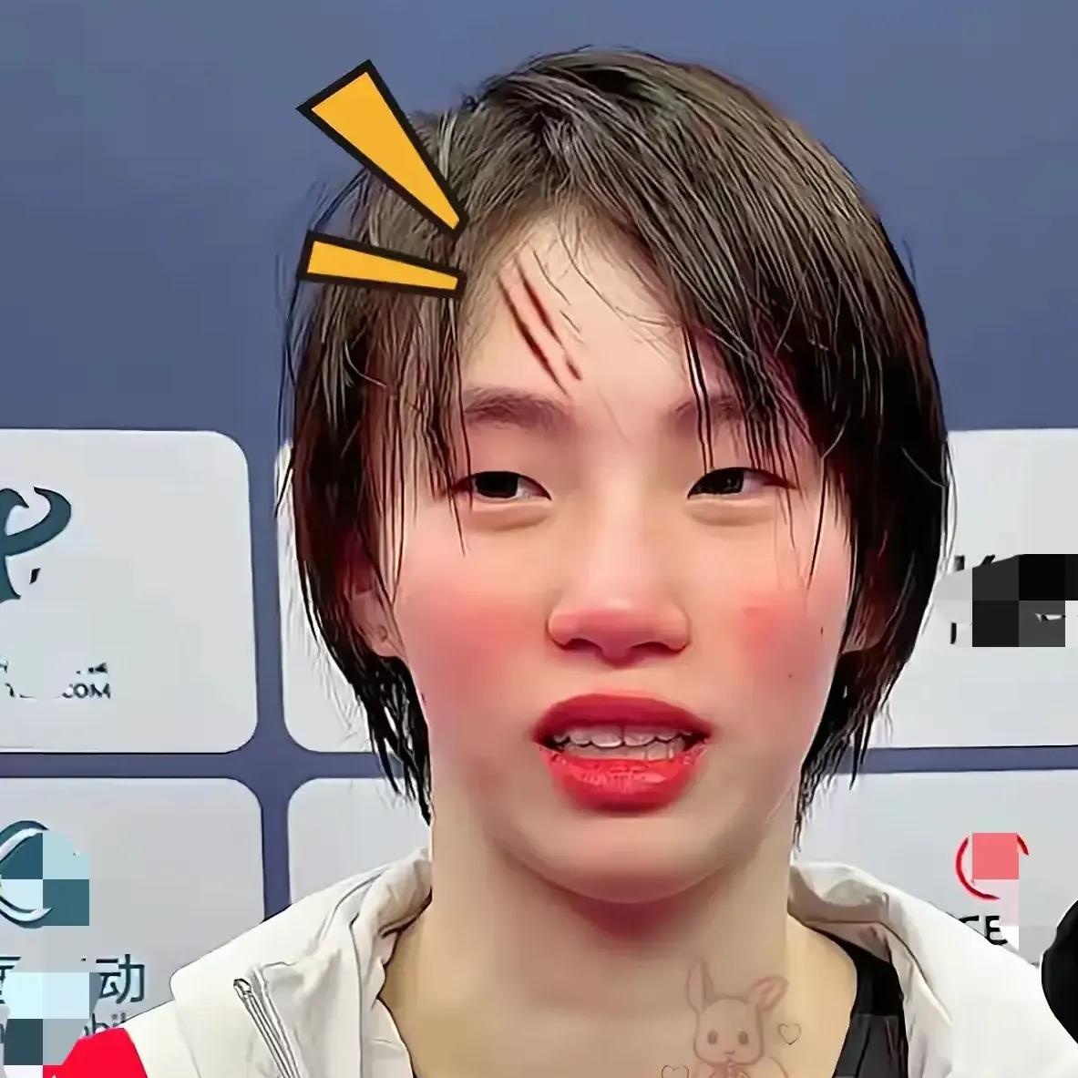 赔率变化明星选手受伤退赛,引发热议 赔率变化明星选手受伤退赛,引发热议